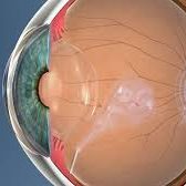 ενδουαλοειδική ένεση